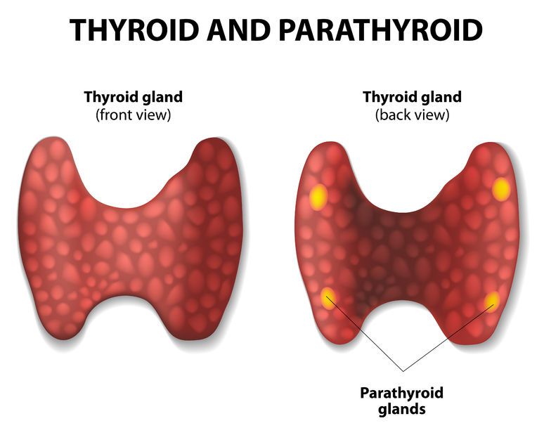 paratireoides cirurgia tireoide